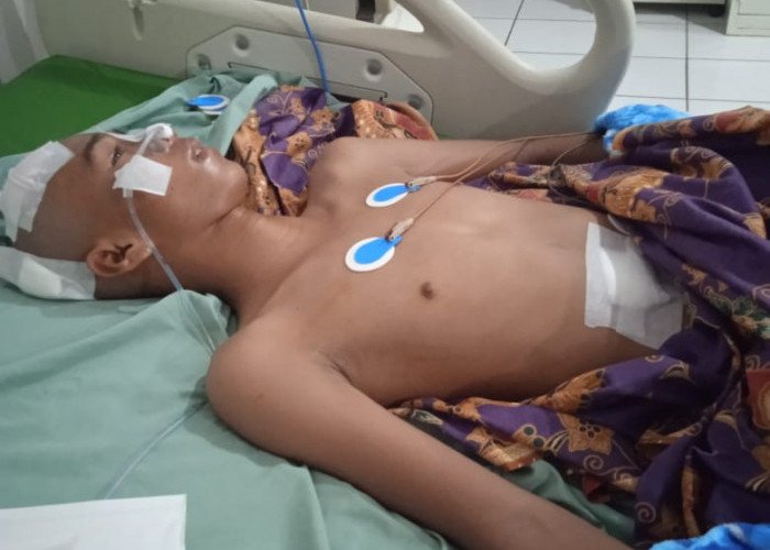 Pemda Kaur Melalui Baznas Bantu Warga Tanjung Kemuning 1 Alami Penyakit Tumor Otak
