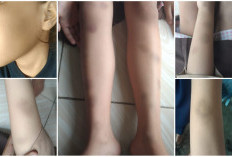 BREAKING NEWS! Murid Kelas 3 SD di Bengkulu Selatan Jadi Korban Bullying, Pelaku Diduga Anak Oknum Guru