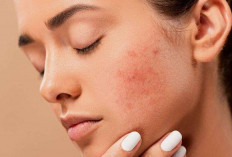 Kulit Sensitif Masalah Umum, 5 Tips Memilih Skincare yang Tepat