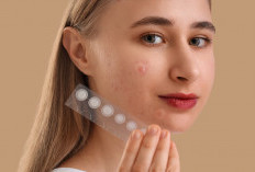 Solusi Praktis Untuk Atasi Jerawat, Kupas Tuntas Pilihan Acne Patch Terbaik di Sini!