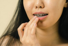 Punya Bibir Hitam Bingung Cari Produk Lipstik yang Cocok, Ini Dia Pilihan Paling Mantap