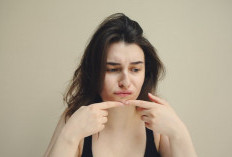 Jerawat Tak Kunjung Hilang Meski Sudah Pakai Acne Patch? Cek Dulu Ini