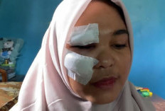 Ditabrak Lari Mobil Fortuner di Simpang Kapuas Raya, Korban Menunggu Tanggungjawab Pelaku