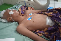 Pemda Kaur Melalui Baznas Bantu Warga Tanjung Kemuning 1 Alami Penyakit Tumor Otak