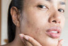 Info Penting! Ini Dia Tips Ampuh Perbaiki Skin Barrier yang Rusak!