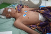 Pemda Kaur Melalui Baznas Bantu Warga Tanjung Kemuning 1 Alami Penyakit Tumor Otak