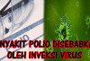 Penyakit Polio Disebabkan Inveksi Virus, Bisa Menular, Ini Penjelasan Detailnya